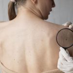 conheca-os-diferentes-tipos-de-cancer-de-pele-e-os-principais-sintomas